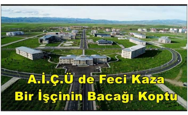 Üniversitede İnanılmaz Kaza İşçinin Bacağı Koptu